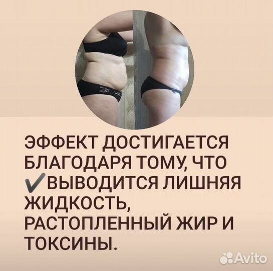 Карамельная липосакция