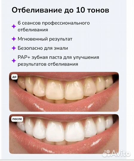 Набор для отбеливания зубов