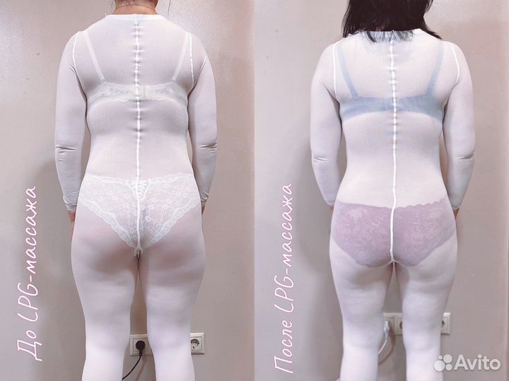 Массаж тела / Массаж лица / LPG-массаж лица и тела