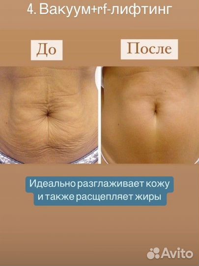 Массажист аппаратный