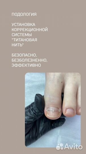 Педикюр подолог