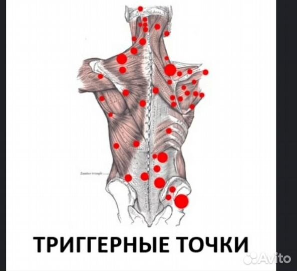 Миопрессура. Акупрессура. Миофасциальная терапия