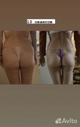 Массаж, коррекция фигуры, активное похудение