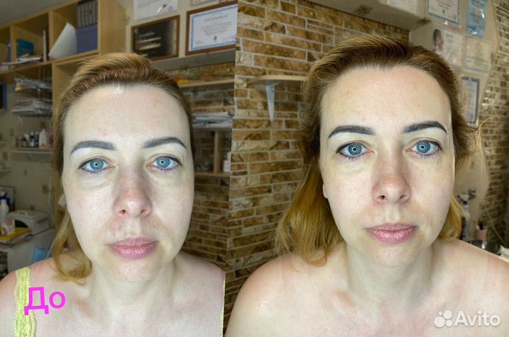 Массаж лица и тела