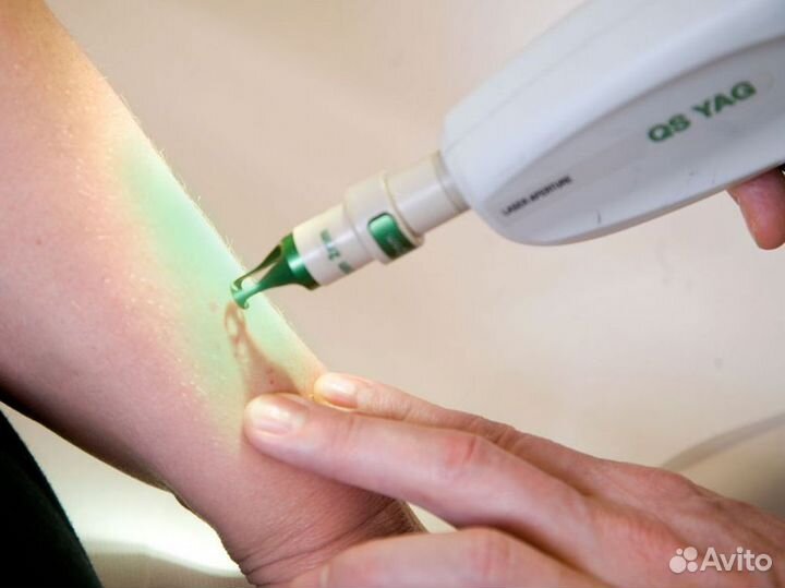 Продается готовый бизнес — лазерная эпиляция