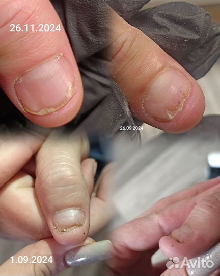 Педикюр kane PAP, парамедицинский, подология