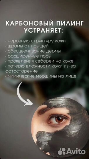 Карбоновый пилинг