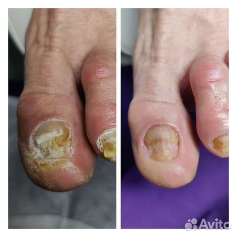 Подолог Московский р-н