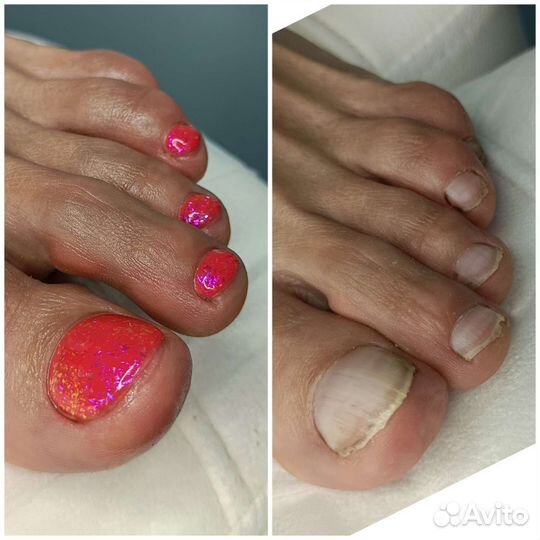 Подолог Педикюр мужской и женский