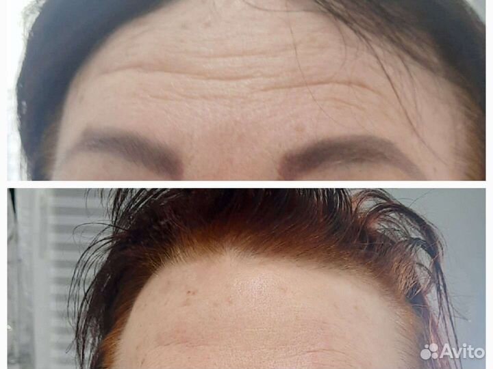 Массаж лица. Лучшие массажные техники