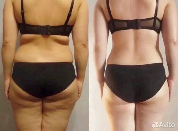 Антицеллюлитный массаж, скульптура тела и лица