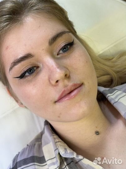 Биоревитализация