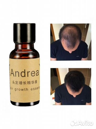 Сыворотка Андреа для роста и от выпадения волос