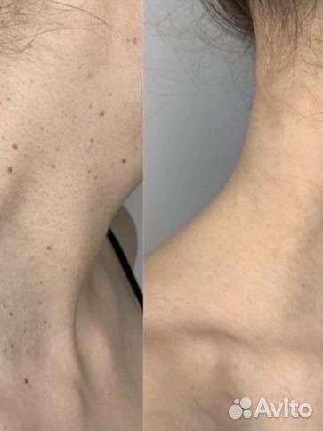 Услуги косметолога