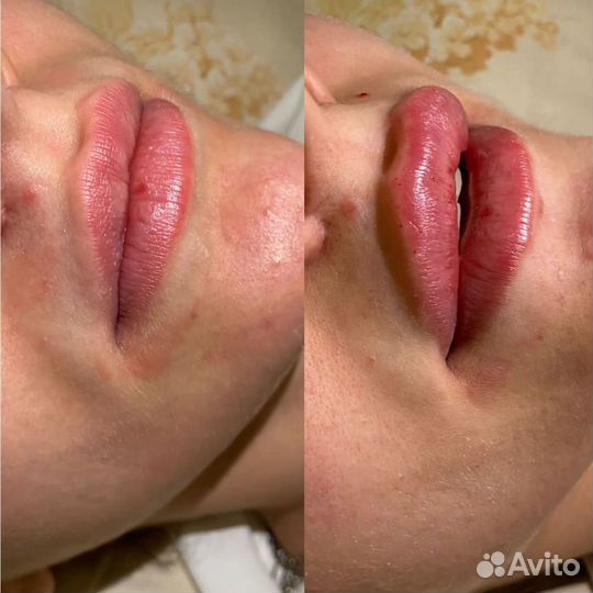 Врач косметолог