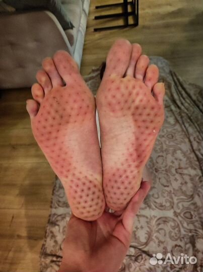 Гвоздестояние индивидуальная практика