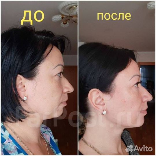 Массаж