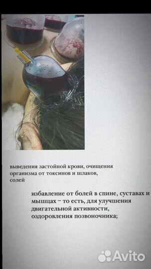 Обучение хиджама