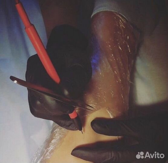 Электроэпиляция Нежинка Пригородный