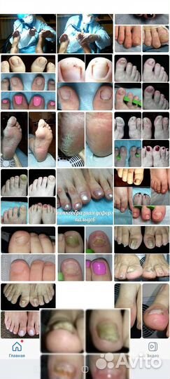 Подолог. Косметолог. Парикмахер. Маникюр Б. Козино