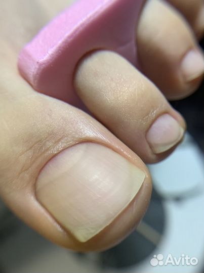 Smart Педикюр озерки