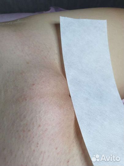 Депиция сахар/воск