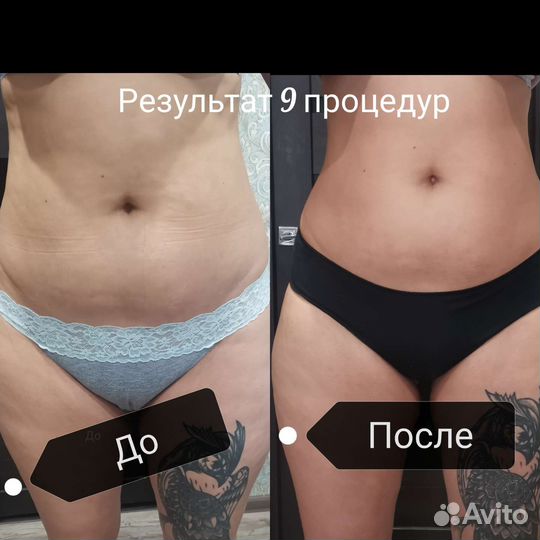 Массаж