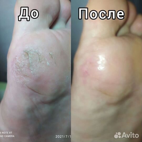 Смарт педикюр/маникюр