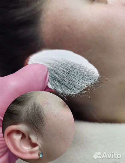 Шугаринг депиляция удаление волос воском