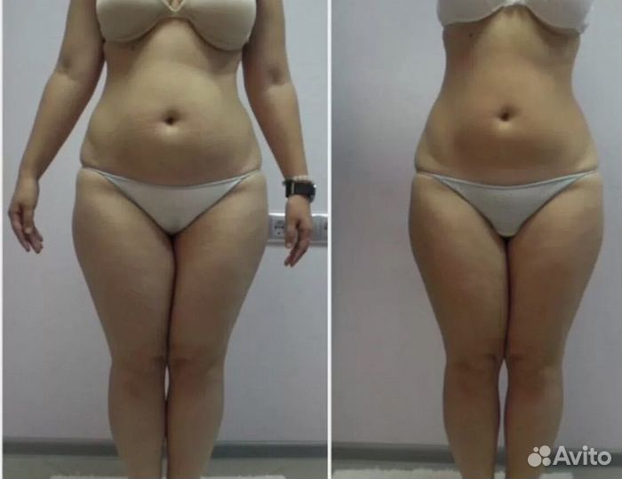 Ультразвуковая Кавитация