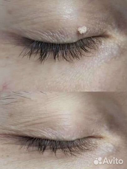 Услуги косметолога