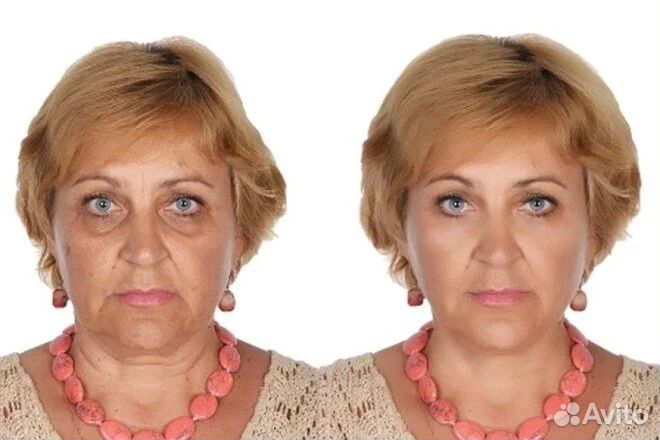 Редактирование фотографий на докуметн