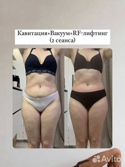 Аппаратный массаж