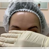 Ботокс в лицо: лоб+глаза от врача-косметолога, Химки