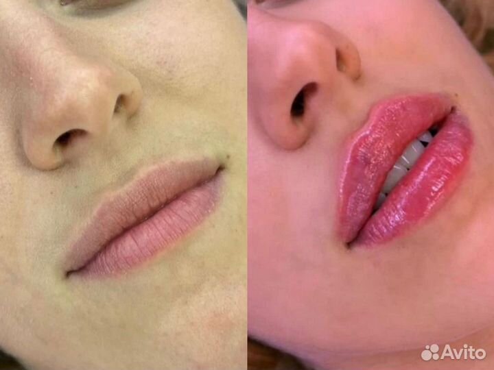 Услуги косметолога