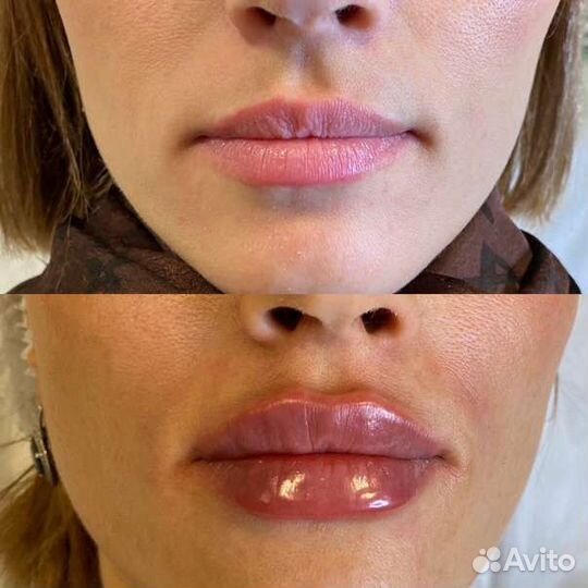 Косметолог на дому