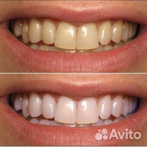 Сертификат на зубы