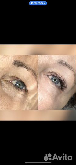 Наращивание ресниц