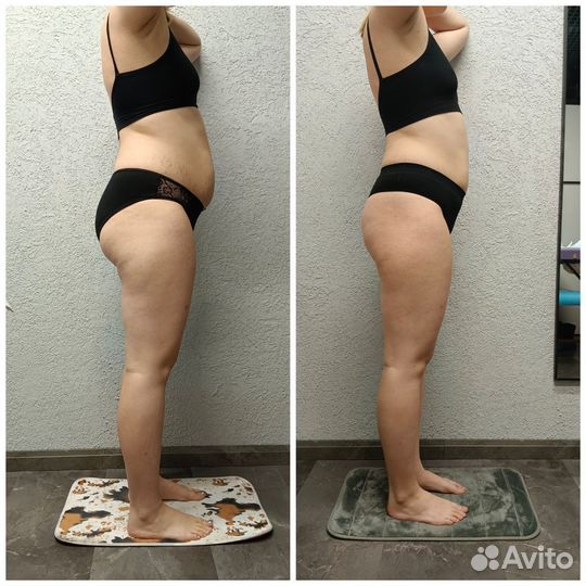 Аппаратный массаж/Вибромассаж