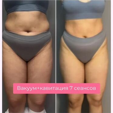 Коррекция фигуры/ вакуум