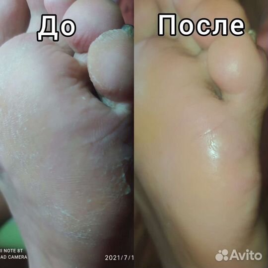 Смарт педикюр/маникюр