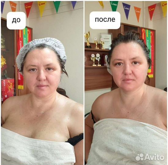 Биоэнергомассаж