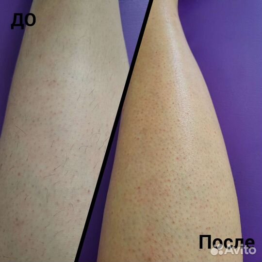 Ищу модель на депиляцию воск/ сахар