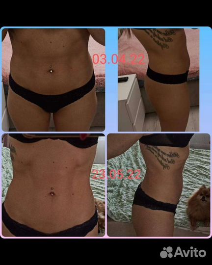 Криолиполиз