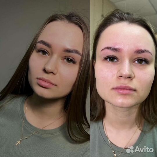 Бровист
