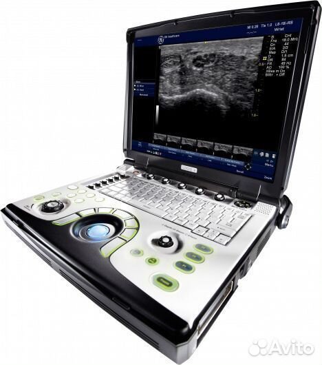 Узи аппарат General Electric Logiq E