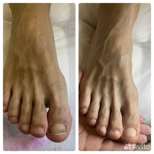 Педикюр с выездом на дом