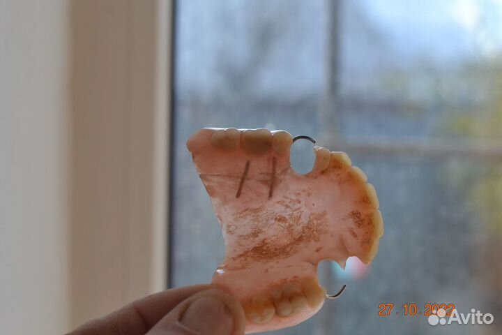 Ремонт акриловых зубных протезов.Только ремонт