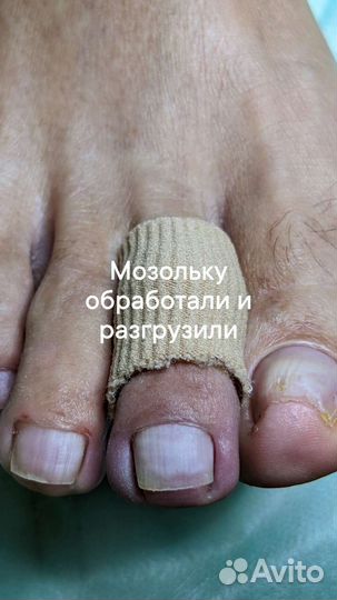 Услуги подолога