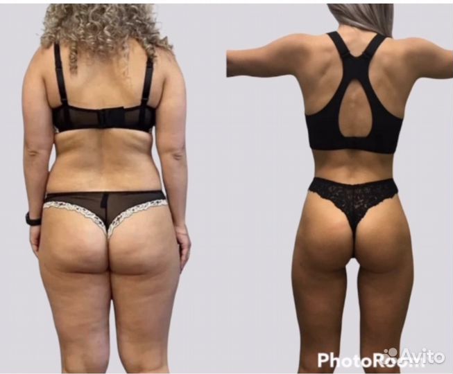 Студия аппаратного массажа